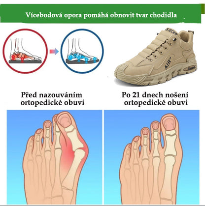 Turistická obuv Slancks® | ✅️Korekce držení těla při chůzi - Voděodolná a protiskluzová 👞